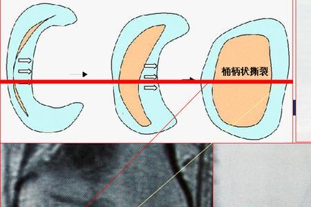 红区和白区是什么意思