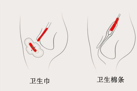 姨妈巾为什么里面会有两个小的