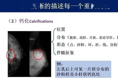 什么是x线密度