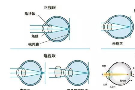 验光红绿对比原理是什么