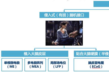 基础科学为什么不支持脑机接口