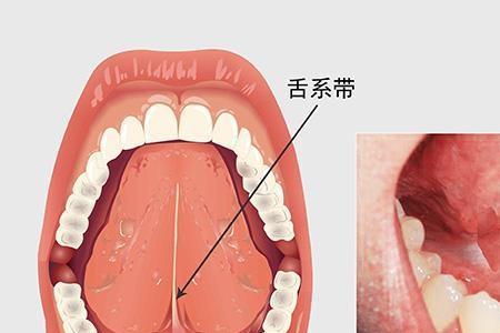 切缘什么意思