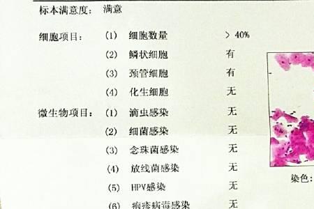 tct报告怎么看