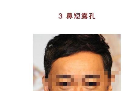 铜锣眼睛男人性格特征