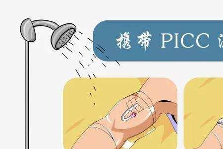 PICC管是什么