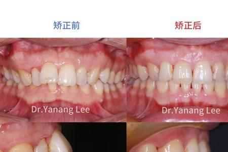 照例和按例有什么区别