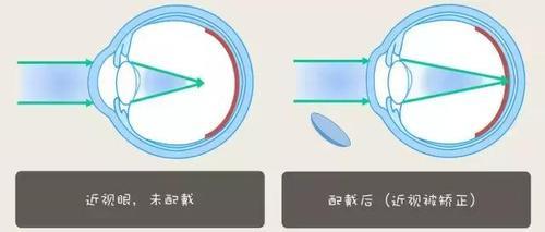 ok镜太滑是什么原因