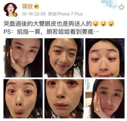 女生说眼睛哭肿了怎么回