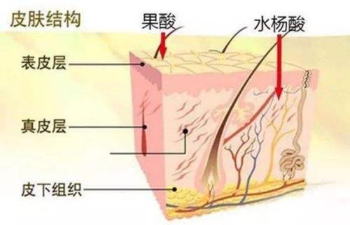 水杨酸可以稀释洗澡吗