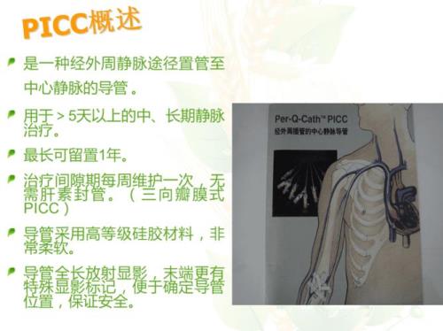 医院pcc管是什么意思