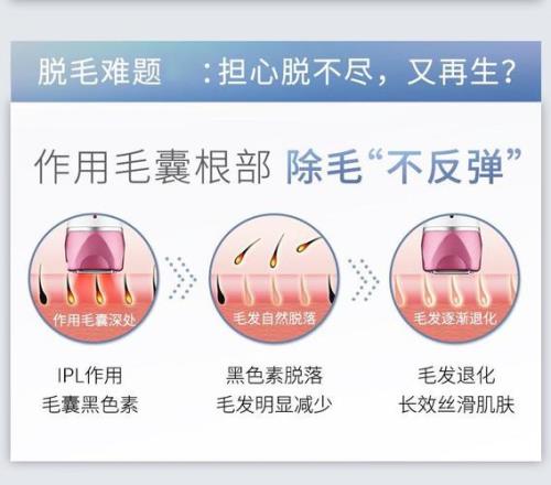 激萌脱毛仪正确使用方法