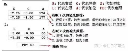 验光数据如何看顺规还是逆规