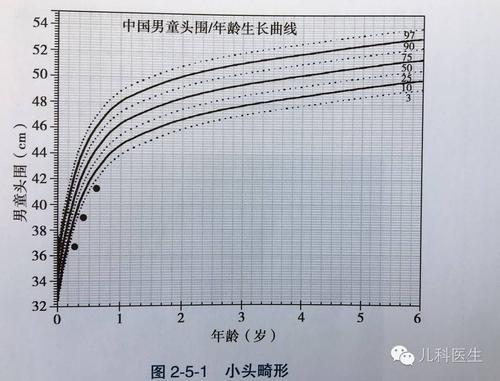 头围是怎么简写的